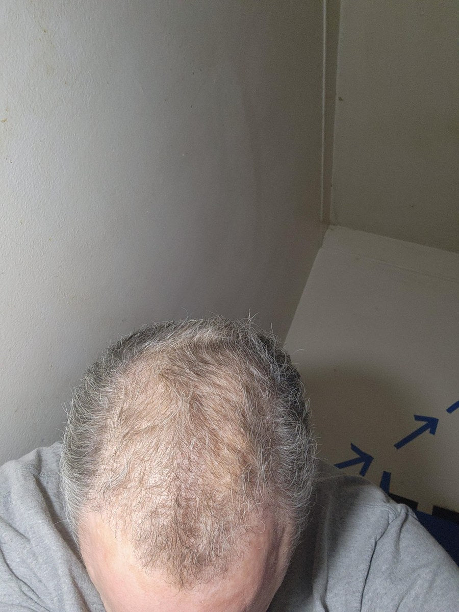 Donald Papp before Maneup Labs Restore