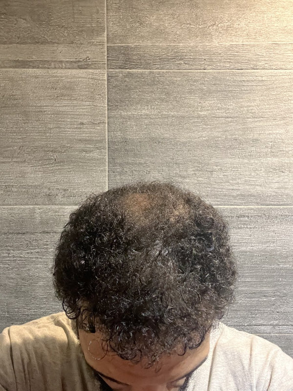 Aygen James after Maneup Labs Restore