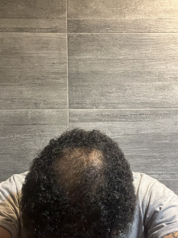 Aygen James before Maneup Labs Restore