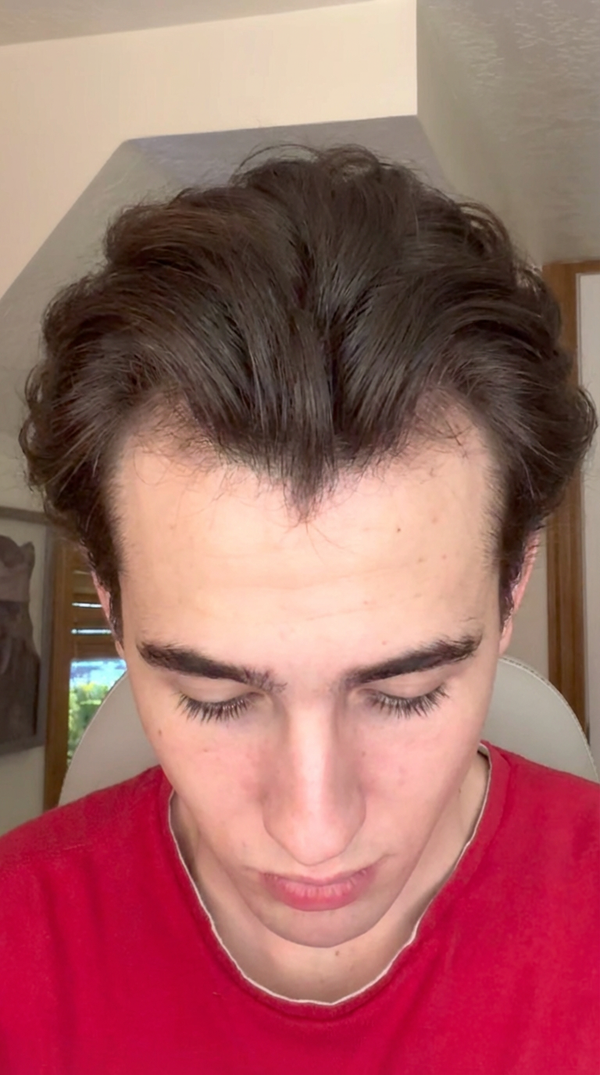 Benjamin Trammell before Maneup Labs Restore