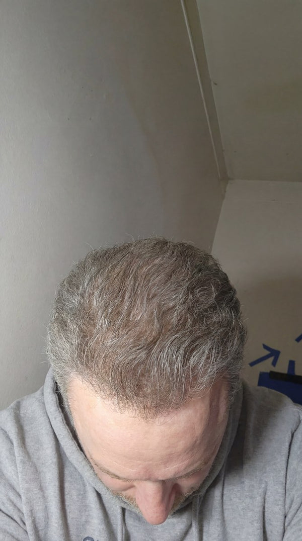 Donald Papp after Maneup Labs Restore