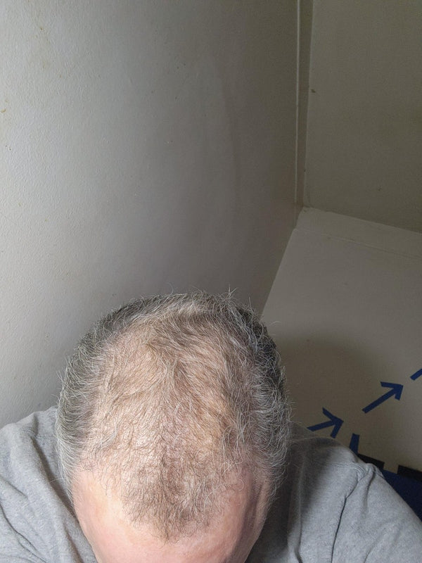 Donald Papp before Maneup Labs Restore