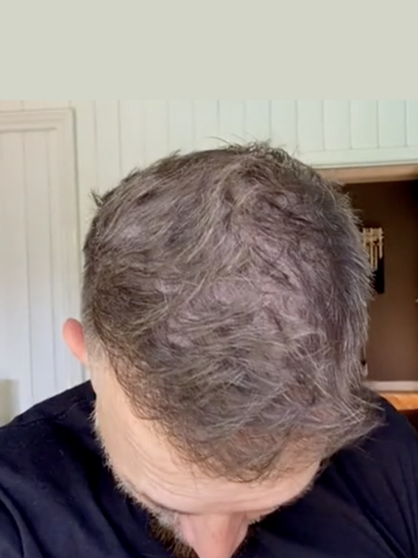 Jonathan G. after Maneup Labs Restore