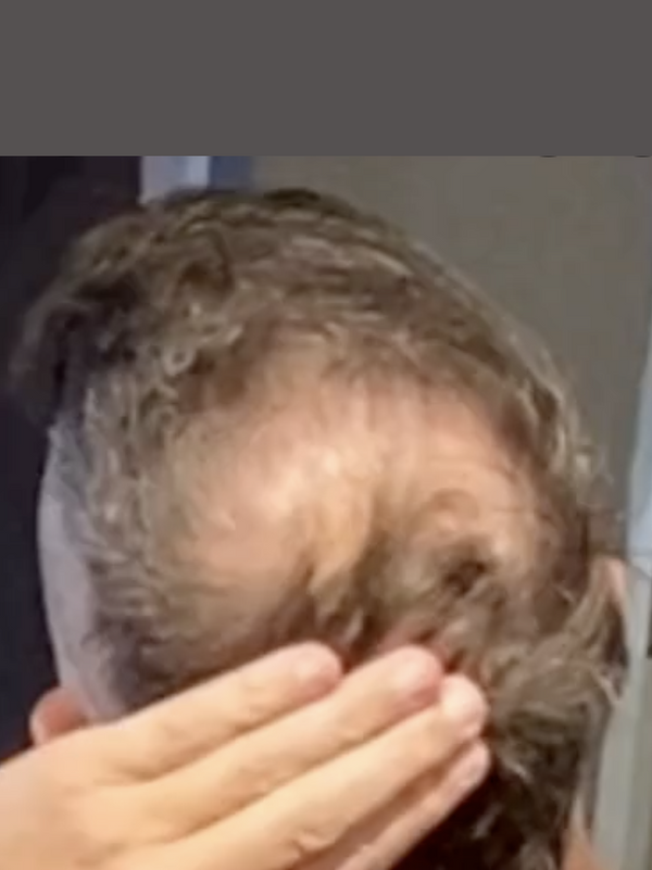 Jonathan G. before Maneup Labs Restore