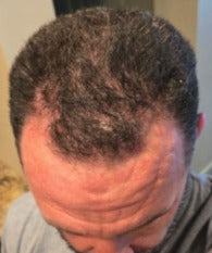 Tyler Johnson after Maneup Labs Restore