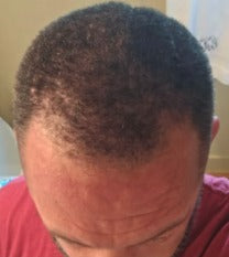 Tyler Johnson before Maneup Labs Restore