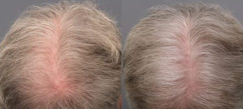 Jude T. before and after